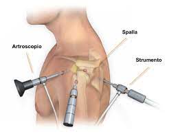 chirurgia-artroscopica-casa-di-cura-piacenza